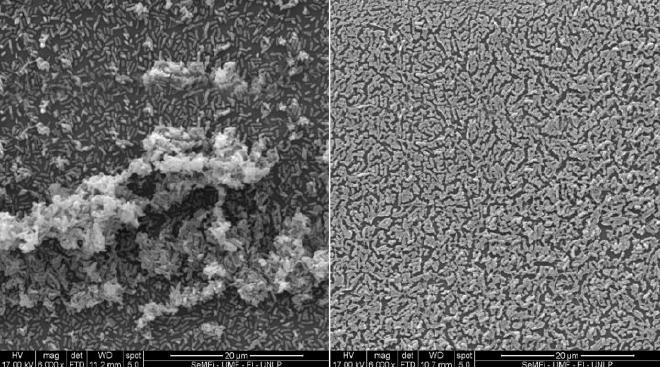 Imágenes de microscopía electrónica: a la izquierda se observan estructuras de biofilms por bacterias sin calcio ni albúmina sérica, y a la derecha, el mismo proceso en presencia de ambas sustancias. Gentileza investigadores.