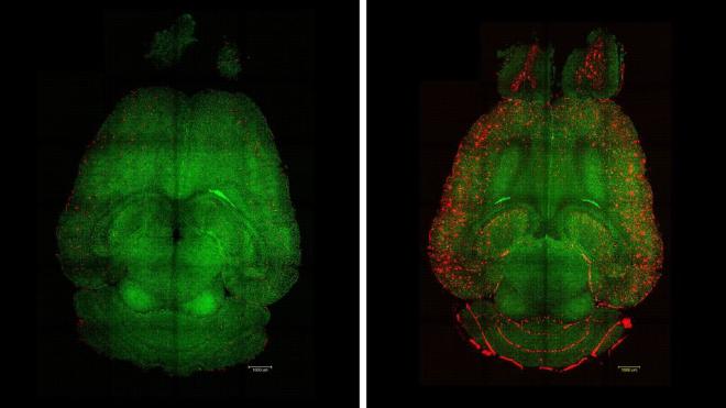 Imágenes de microscopía de fluorescencia basada en hoja de luz del cerebro de un ratón 12 horas después de haber sido tratado (izquierda) o no (derecha) con nanopartículas. Se analizaron los cerebros para ver la cantidad de acumulación de placas Aβ. Rojo: placas Aβ. Verde: vasos sanguíneos de la barrera hematoencefálica. Crédito de la imagen: Institute for Bioengineering of Catalonia (IBEC)